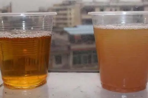 麦吉科普|尿黄是因为肝肾不健康吗？这6种原因都有可能，一文自查了解