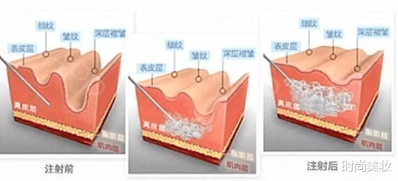 时尚美妆|36岁黄录圣依素颜出镜,好皮肤实力抢镜,让戚薇赞叹不已