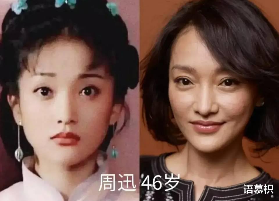 娱乐圈|娱乐圈就是整容场？开挂式逆袭？明星出道前后对比，你认出了几个