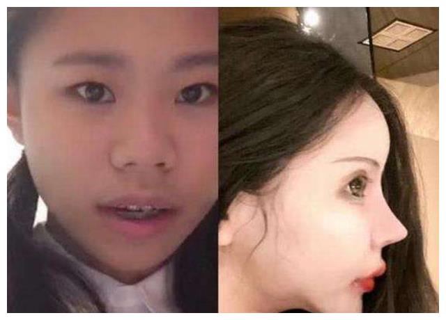 Hi家有小甜椒儿|花费上百万，3年整了上百次的女孩，就是为了把自己“整残”？