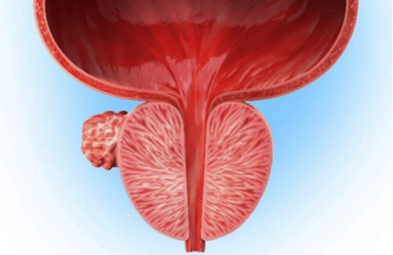 大脑|男人的“守护神”找到了，不是生蚝，男人可劲吃，前列腺一天天变强