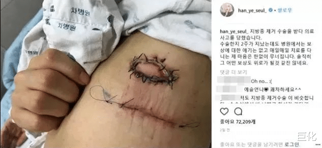 韩艺瑟|封杀三年，这妖精终于杀回来了…