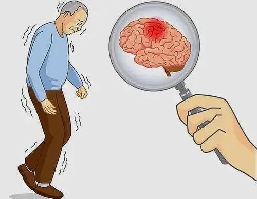 红枣|男子一觉醒来，半边身子动不了，医生：中风了，都是因为这个习惯