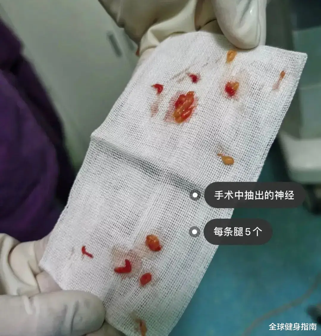 |1.4亿女生点赞，却被网友喷成狗：这不是性感，这是自残！