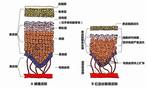 珑阳谈护肤 你还在找解决红血丝的秘诀吗？这几招教你解决红血丝