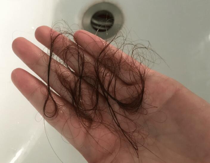 洗发水 三种进入“黑名单”的洗发水，价格高又难用，头屑反复且脱发严重