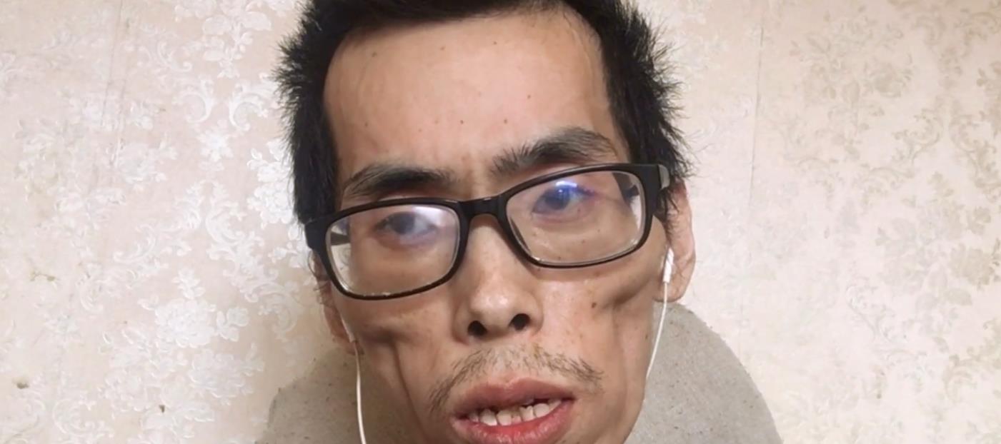 抗癌|一路走好！抗癌网红阿健去世，短短一年瘦到皮包骨头，灵堂照曝光