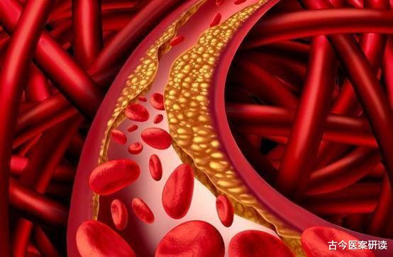 失眠|血脂“分解器”被扒出，吃一口相当8斤芹菜，医生：敞开吃，脑梗远离你