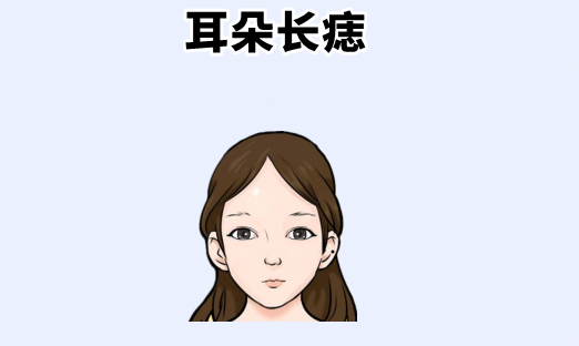 中国易经风水|女人4颗“招财”痣，婚前不愁钱，婚后不缺钱，丈夫马上走大运！