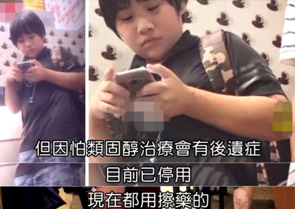 肖浩飞白|小小彬：5岁成名，被生父继母“吸血”1800万，皮肤溃烂无钱治