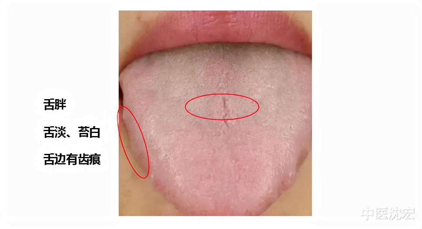 中药|畏寒怕冷 阳虚体质？给你一味中药，温补肾阳，从而温暖全身