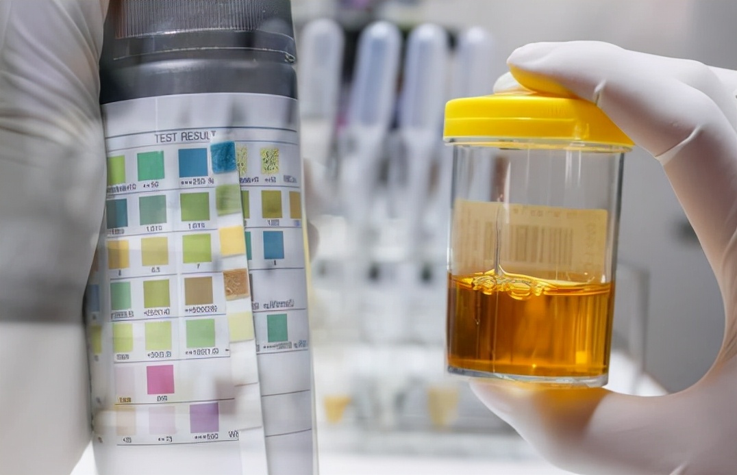 肾衰竭|多家医院联合声明：马上停止“3个”习惯，会加速肾衰竭，趁早改掉