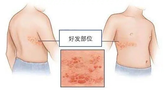 麦吉科普 世界上最疼的病，你知道是什么吗？经历过的都是“超人”