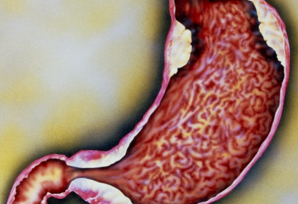 蔬菜|卫生组织曝光的“致癌蔬菜”,不少人视为养生菜,不想胃烂成渔网,尽早忌口