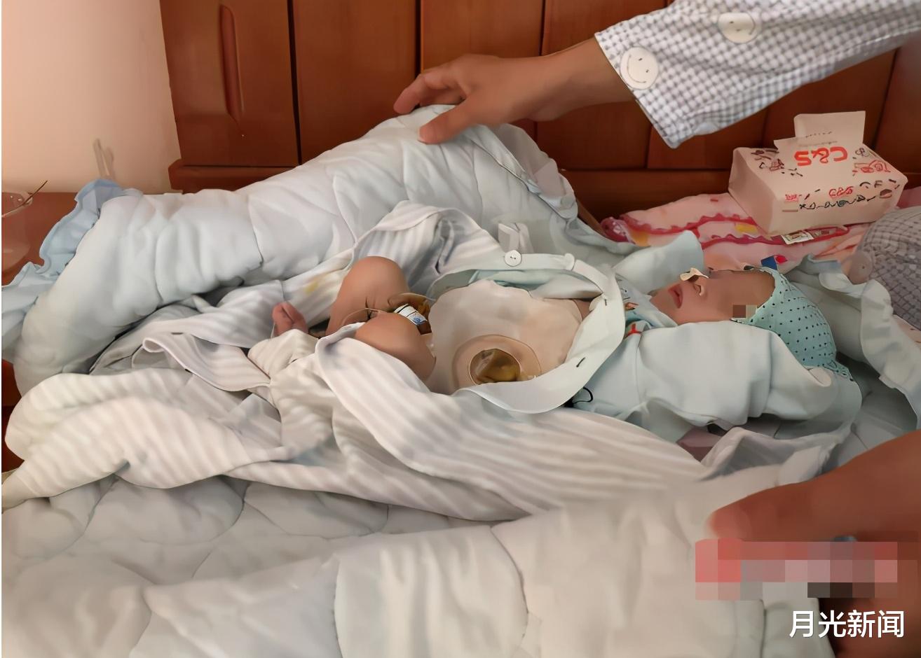 月光新闻 广西一新生儿没有肛门，三天后才被发现，出生仅16天就患病离世