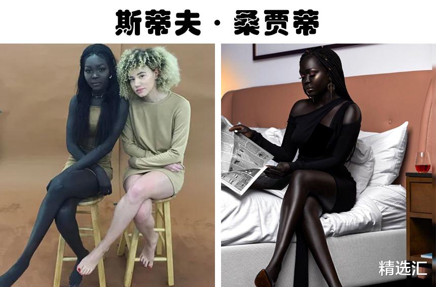 你见过蓝色皮肤的人吗？这个世界上，5个拥有奇怪特征的人类