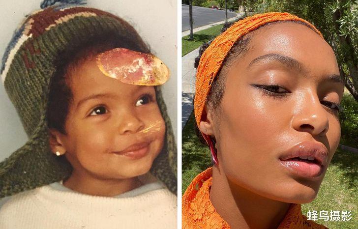 美丽|18张对比照看那些，因美丽成名的孩子们，他们现在怎么样了？