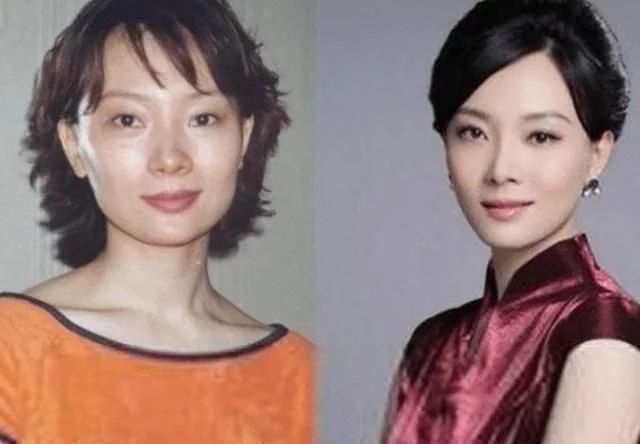 整容|“整容最成功”4位女星，钟楚曦没想到，最后一位不说绝对看不出