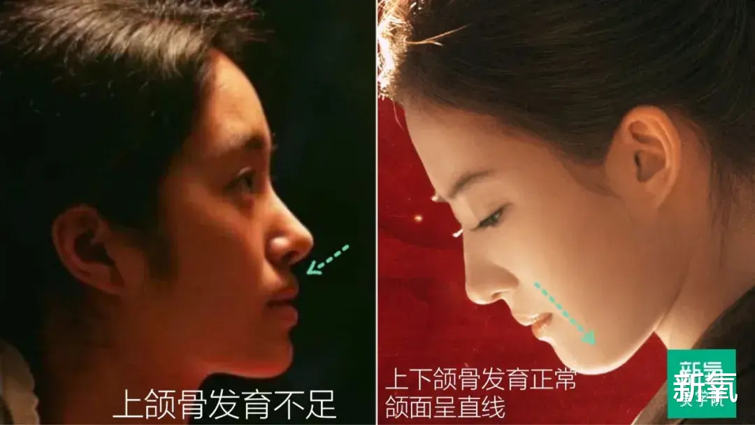 宋祖儿|撞脸天宝的北影第一美，颜值吊打室友宋祖儿，侧脸却一言难尽…