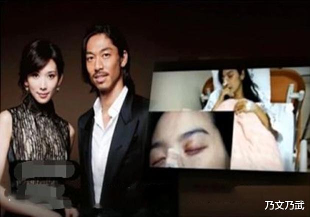 林志玲|林志玲远嫁日本被家暴入院，为何与言承旭分手，真相太尴尬了