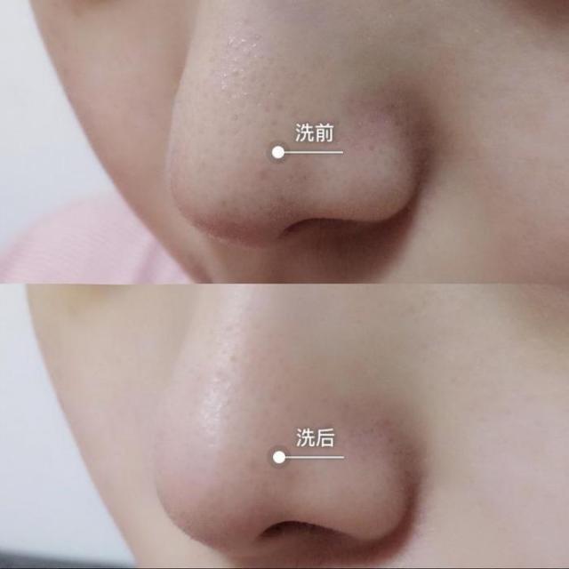 洗面奶 长期清水洗脸和洗面奶洗脸，“差距”会有多大？说出来你或许不信