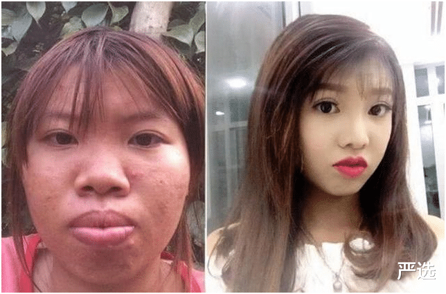 严选|8年前整容成白雪公主的女人,如今竟成这般模样?网友:难以相信