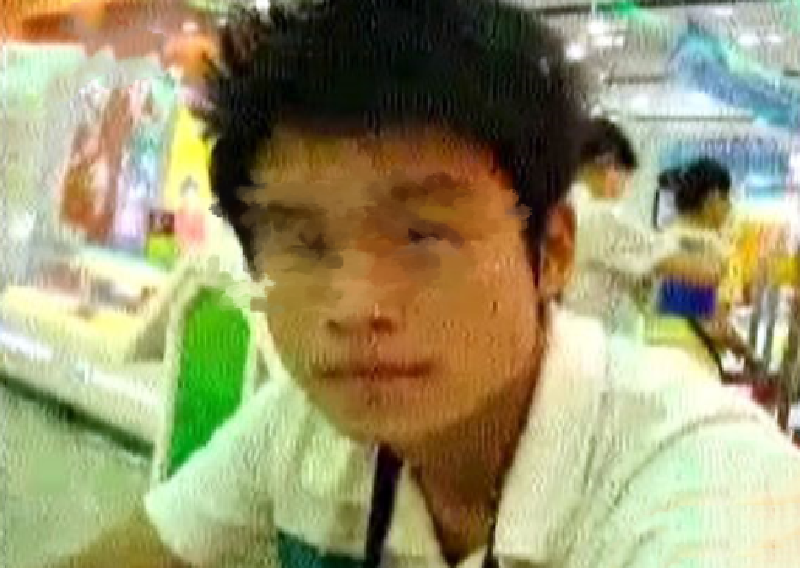 重庆19岁男生与女友分手被泼硫酸,面部毁容,?眼睛永久无法闭合
