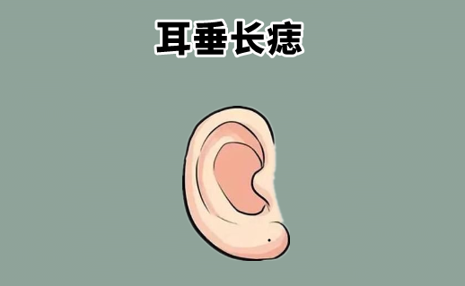中国易经风水|身体4颗“恶”痣要不得，手里不存钱，家里没有房，白忙活一场！