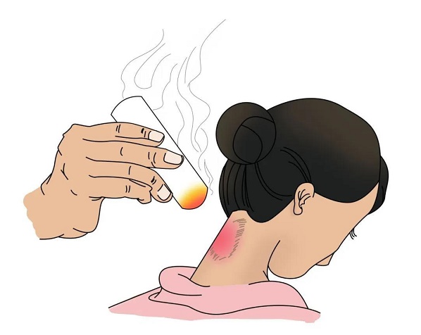 艾灸|你的颜值气血决定