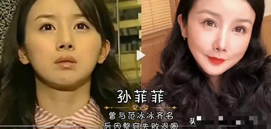 柏雪|突然“消失”明星今昔，杨雪因玻尿酸脱相，小仙女柏雪颜值逆生长。