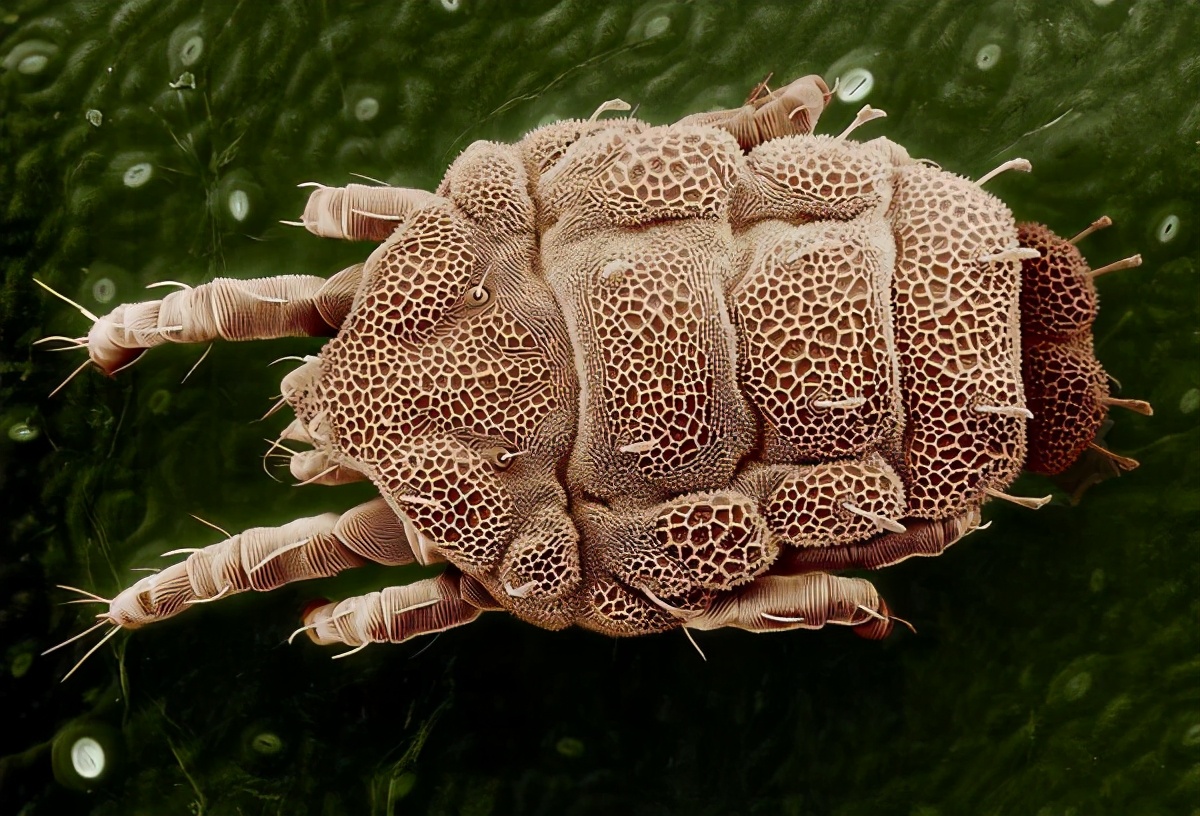 漫说健康|长沙一女子睫毛里发现大量螨虫：这3种现象，暗示可能被螨虫感染