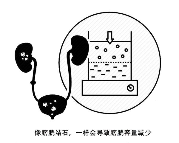 英国|常见的“职业癌”都有哪些？这4种“职业癌”，请注意预防