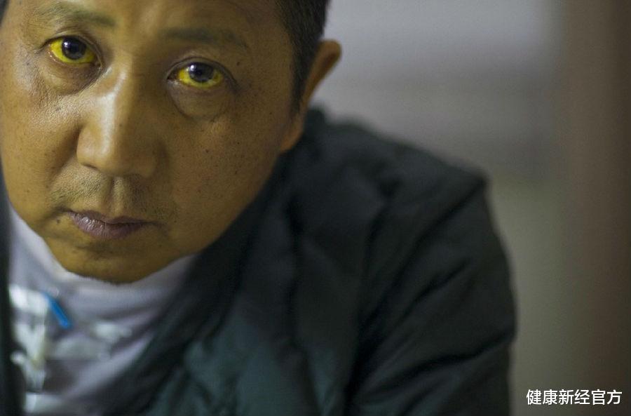 健康新经官方 28岁小伙频繁腹泻，诊断为肝硬化，医生：这“2事”怎能如此放纵？