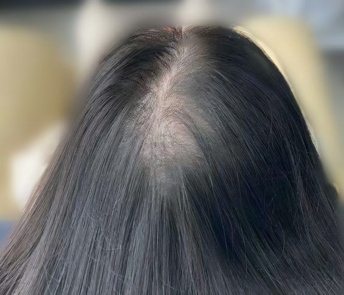 杨幂|杨幂圣诞夜分享动态，状态好似少女，两条粗辫子太让人羡慕了