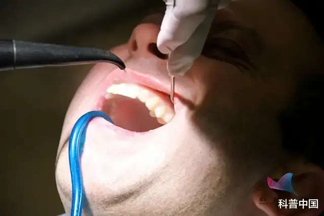 免疫系统|男子洗个牙,竟导致感染性心内膜炎!这几类人务必要警惕