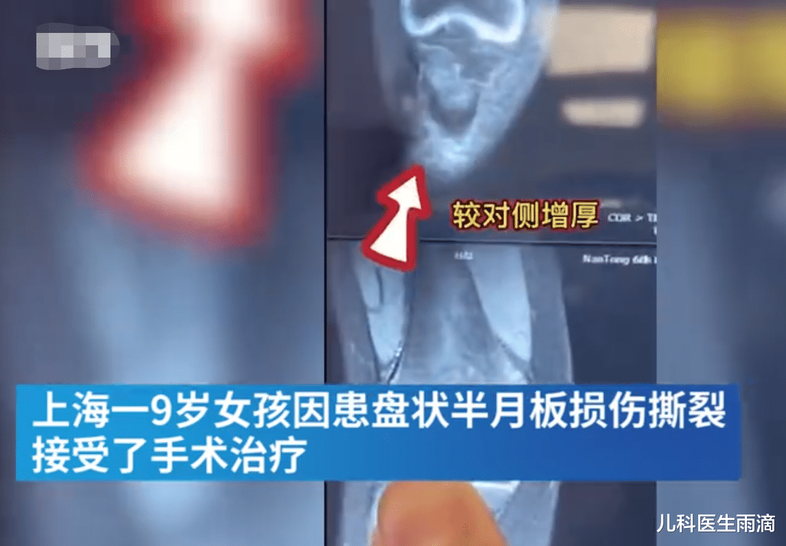 儿科医生雨滴|5岁女孩练舞致截瘫，忍痛康复训练1年已能奔跑，父母：就不买轮椅