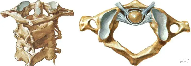 二甲双胍|治了五年的头晕终于找到病因——椎动脉沟环