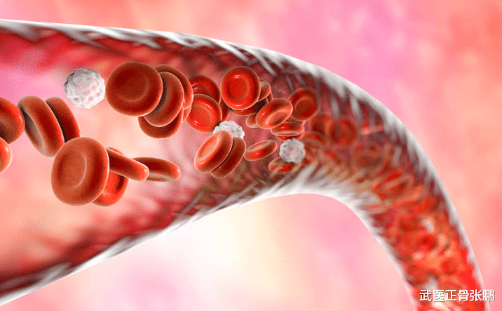 血糖|血液“稀释剂”已找到，不是苹果，每天坚持吃，脑梗不攻自破