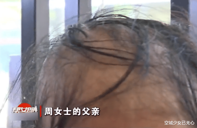 朴信惠 美女去洗完头结果秃成“裘千尺”，美发店：我又没给你用硫酸洗