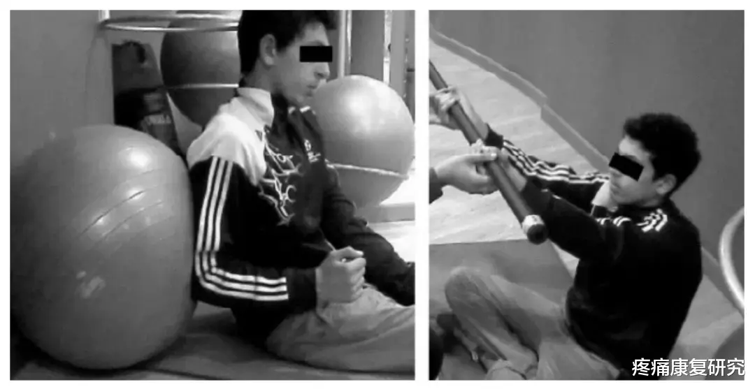 熬夜|三种常见的肩关节脱位及治疗