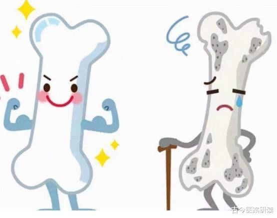 骨密度|48岁大叔养骨半年,骨密度恢复至正常人水平,究竟是如何做到的?