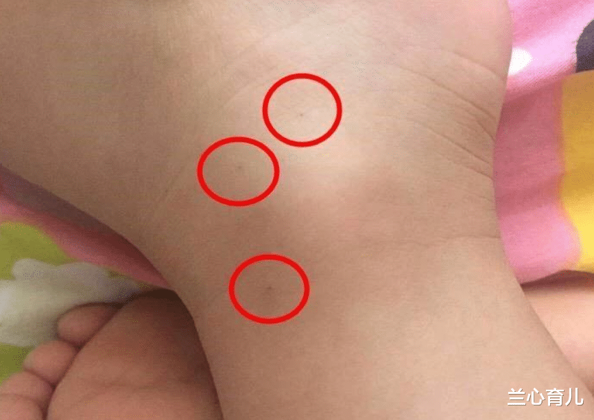 兰心育儿|孩子身上出现针眼,妈妈深夜发家长群声讨,老师:是误会