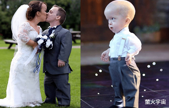 侏儒症|英1.2米女演员与小矮人丈夫享受童话般家庭生活，两娃也是小矮人