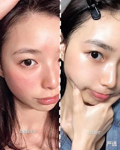 严选|我真没做医美！坚持每晚使用美容仪，半年不到却被说像换了皮