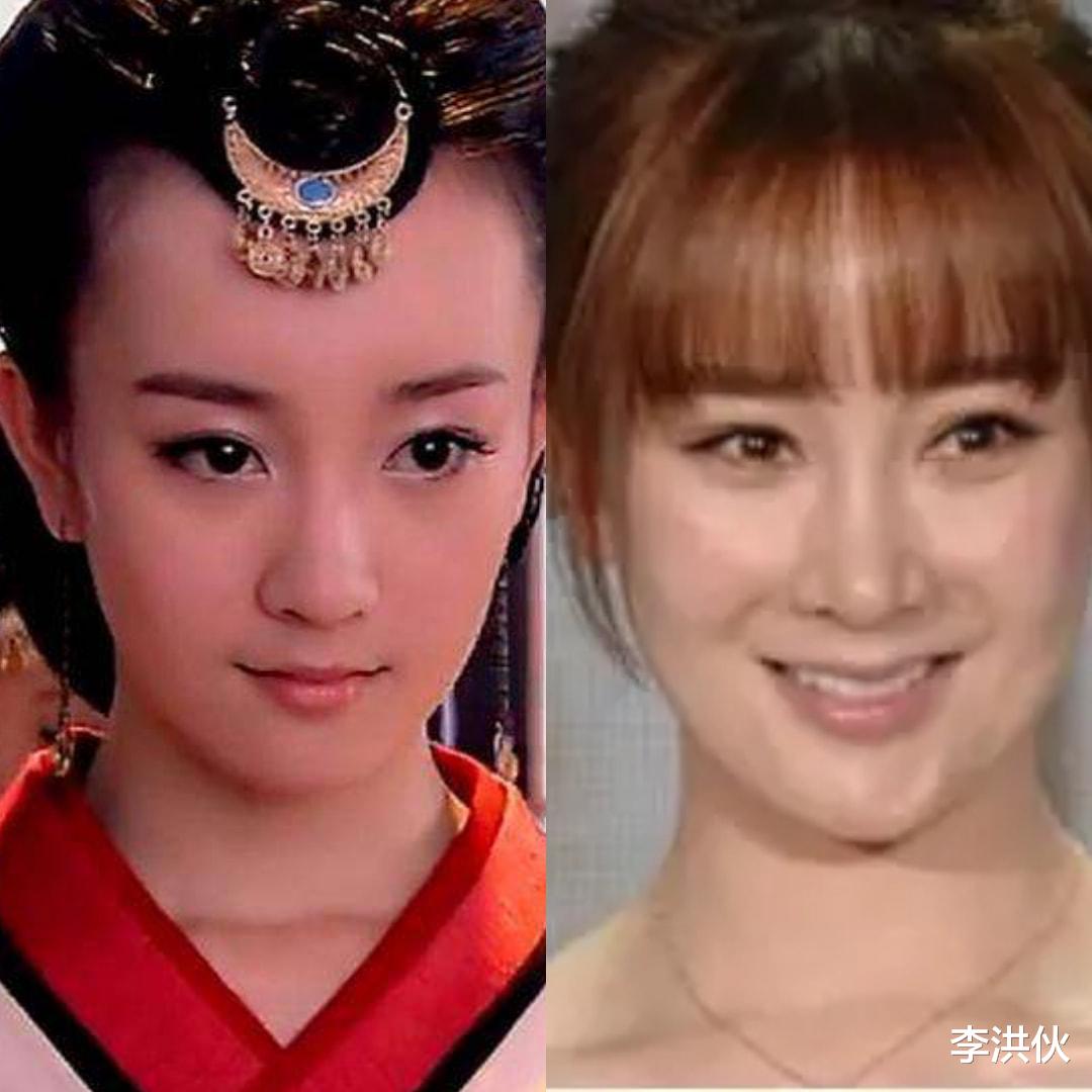 美丽|赵本山徒弟娇娇整容成瘾,割完双眼皮又拉皮,直言害怕自己会变老