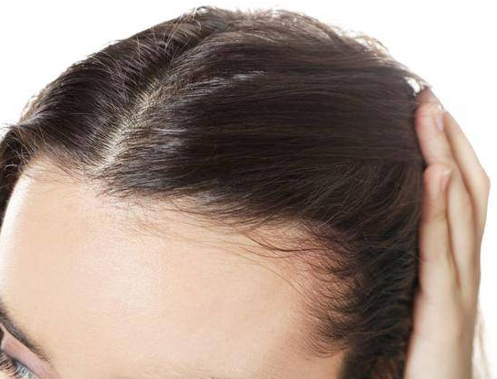 清克颜究所 古芳栢草：年纪轻轻就发际线后移，与哪些因素有关？