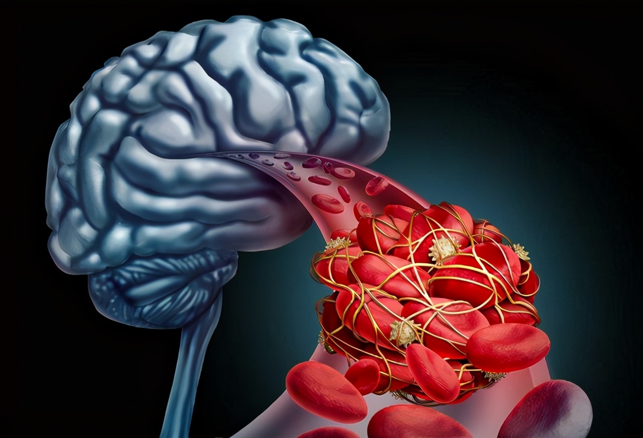 高血脂|高血脂的“祸根”找到了，不是肥肉，而是“1素”，尽量少吃点