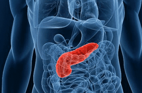 胰腺癌|以为是胃病,却发现是胰腺癌?身体的4个信号,别忽视!