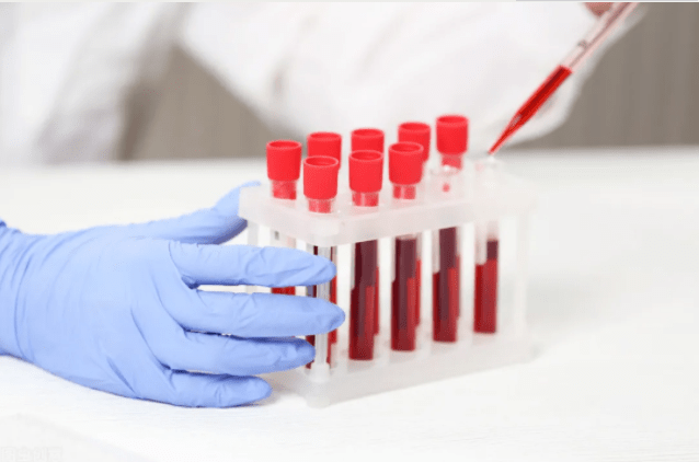 肾病|肾病最易缺乏1种元素对肾不利！这类指标异常是信号，2类药可纠正