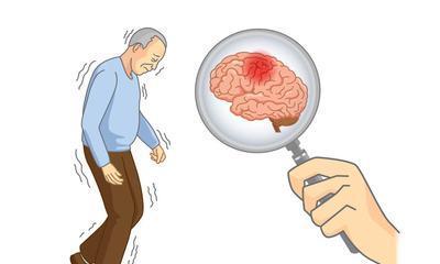 中药|?防中风吃什么？日本研究公布护血管食材：降20％脑梗塞机率